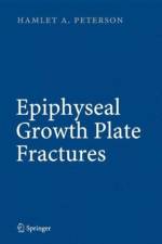 Epiphyseal Growth Plate Fractures af Hamlet A. Peterson