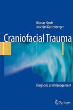 Craniofacial Trauma af Nicolas Hardt