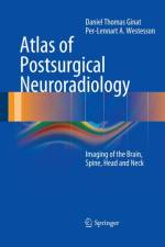 Atlas of Postsurgical Neuroradiology af Daniel Thomas Ginat