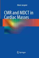 CMR and MDCT in Cardiac Masses af Alexis Jacquier