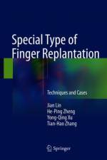 Special Type of Finger Replantation af Jian Lin