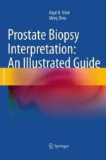 Prostate Biopsy Interpretation: An Illustrated Guide af Rajal B. Shah