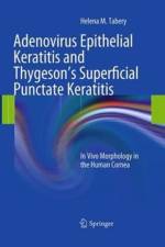 Adenovirus Epithelial Keratitis and Thygeson's Superficial Punctate Keratitis af Helena M. Tabery