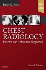 Chest Radiology af James C. Reed