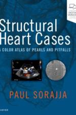 Structural Heart Cases af Paul (Director Sorajja