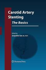 Carotid Artery Stenting: The Basics