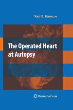 Operated Heart at Autopsy af Stuart Lair Houser