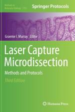 Laser Capture Microdissection