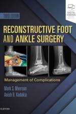 Reconstructive Foot and Ankle Surgery: Management of Complications af Mark S. Myerson