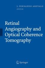 Retinal Angiography and Optical Coherence Tomography