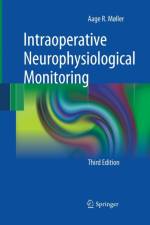 Intraoperative Neurophysiological Monitoring af Aage R. Møller