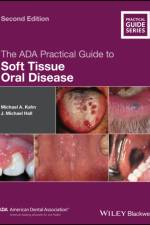 The ADA Practical Guide to Soft Tissue Oral Disease