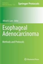 Esophageal Adenocarcinoma
