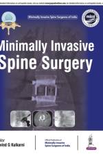 Minimally Invasive Spine Surgery af Arvind Kulkarni