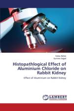 Histopathlogical Effect of Aluminium Chloride on Rabbit Kidney af Sajjad Sumera