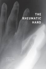 Rheumatic Hand af Raphael Micheroli