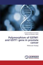 Polymorphism of GSTM1 and GSTT1 gene in prostate cancer af Hasan Osamah Mohammed