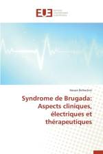 Syndrome de Brugada af Belhachmi-H