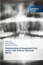 Relationship of Impacted third molar with Inferior Alveolar Nerve af Rai Shalu