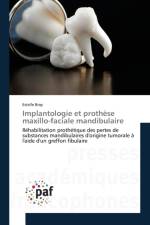 Implantologie Et Prothese Maxillo-Faciale Mandibulaire af Bray-E
