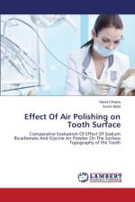 Effect Of Air Polishing on Tooth Surface af Chopra Nazia