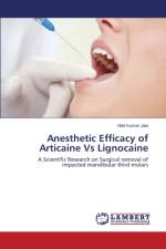 Anesthetic Efficacy of Articaine Vs Lignocaine af Jain Nikil Kumar