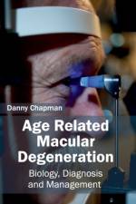 Age Related Macular Degeneration: Biology, Diagnosis and Management