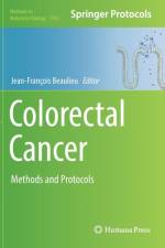 Colorectal Cancer