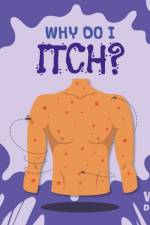 Why Do I Itch? af Kirsty Holmes
