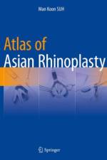 Atlas of Asian Rhinoplasty af Man Koon SUH