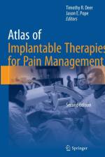 Atlas of Implantable Therapies for Pain Management
