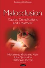 Malocclusion
