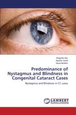 Predominance of Nystagmus and Blindness in Congenital Cataract Cases af Ibrahim Nazia