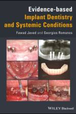 Evidence-based Implant Dentistry and Systemic Conditions af Fawad Javed