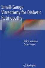 Small-Gauge Vitrectomy for Diabetic Retinopathy af Ulrich Spandau