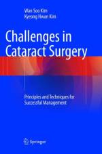 Challenges in Cataract Surgery af Wan Soo Kim