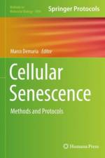 Cellular Senescence