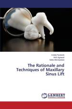 Rationale and Techniques of Maxillary Sinus Lift af Pardeshi Kshitij