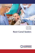Root Canal Sealers af Nikhil Vineeta