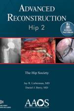 Advanced Reconstruction: Hip 2: Print + Ebook with Multimedia