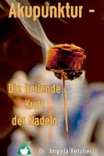 Akupunktur - Die Heilende Kraft Der Nadeln af Angela Fetzner