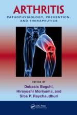 Arthritis