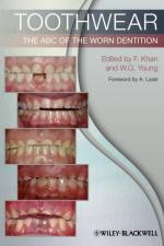 Toothwear af William George Young