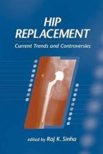 Hip Replacement af Raj K. Sinha