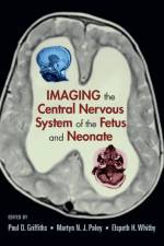 Imaging the Central Nervous System of the Fetus and Neonate