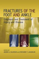 Fractures of the Foot and Ankle