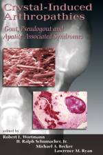 Crystal-Induced Arthropathies