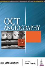 OCT Angiography af Sanja Sefic Kasumovic