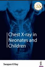 Chest X-ray in Neonates and Children af Swapan K Ray