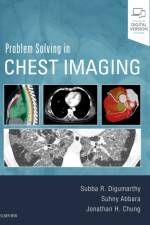 Problem Solving in Chest Imaging af Subba R. (Radiologist Digumarthy